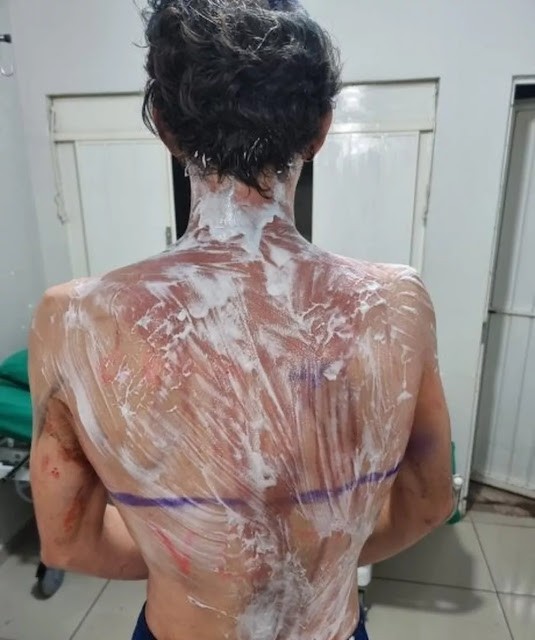 Foto: Reprodução