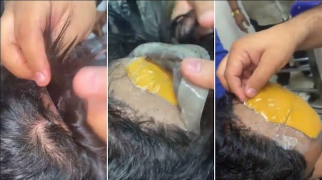 Homem é flagrado com ouro sob peruca e no reto em aeroporto