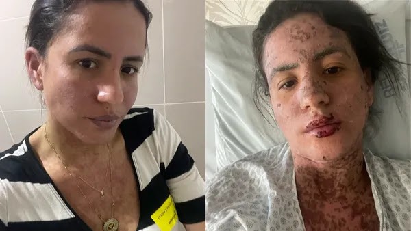 Foto: Reprodução