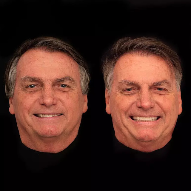 Bolsonaro coloca lentes nos dentes: “Vaidade não faz mal a ninguém”