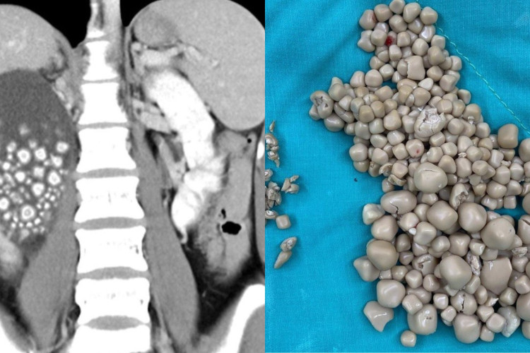 Reprodução/Chi Mei Hospital 