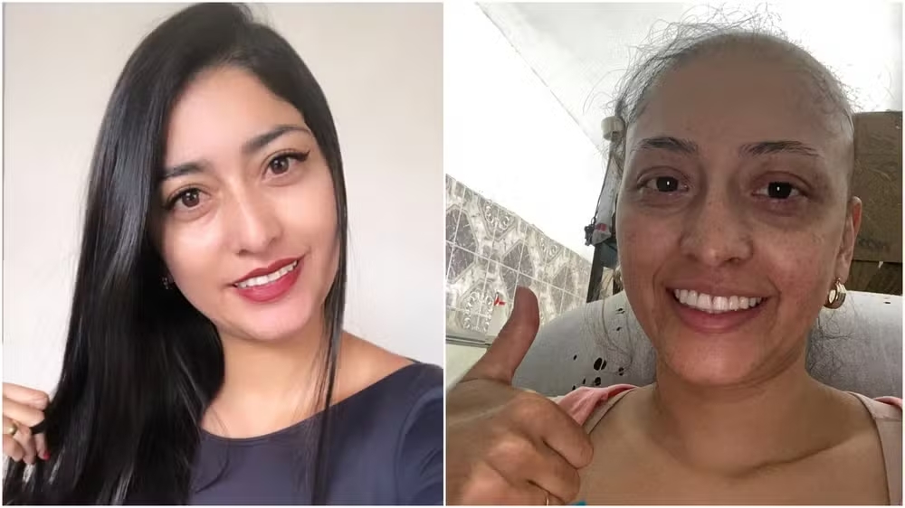 Paciente com câncer denuncia cabeleireiro por furto do cabelo que seria usado em aplicação