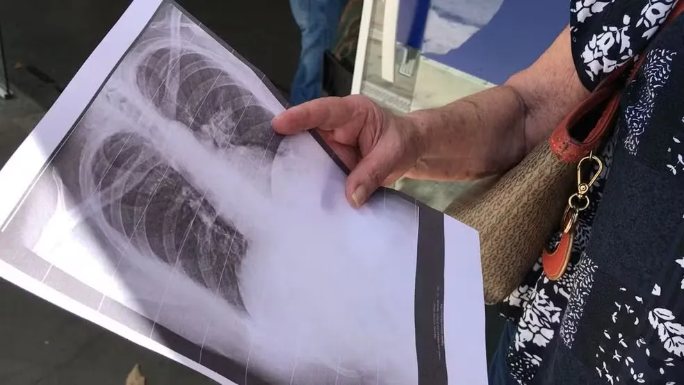 Mulher forçada a ficar nua para fazer raio-x diz que técnico ofereceu dinheiro para não expor o caso