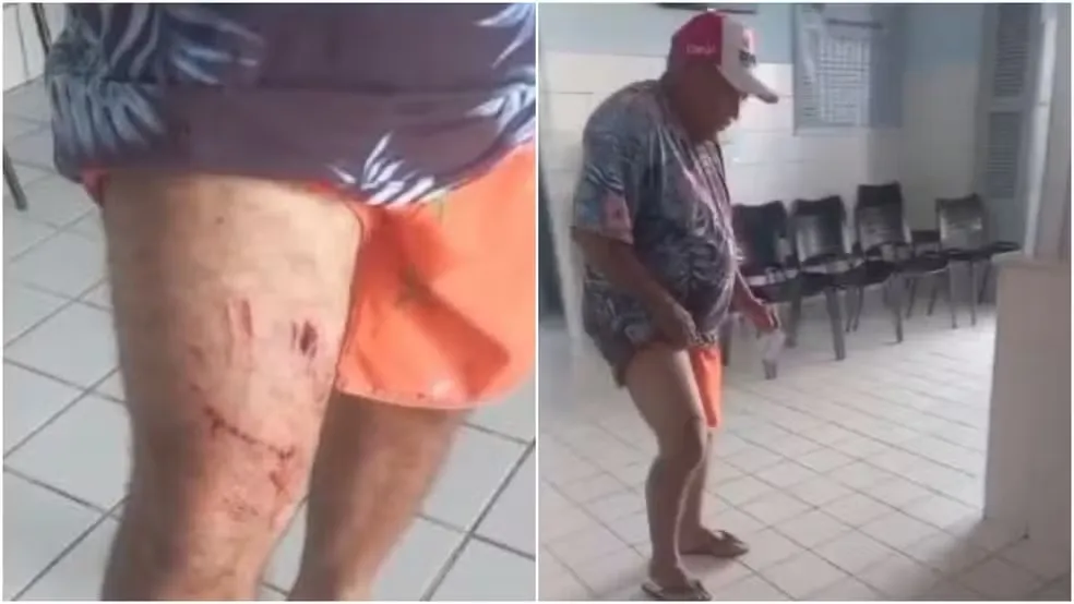 Idoso tem perna mordida por jacaré em lagoa no Ceará
