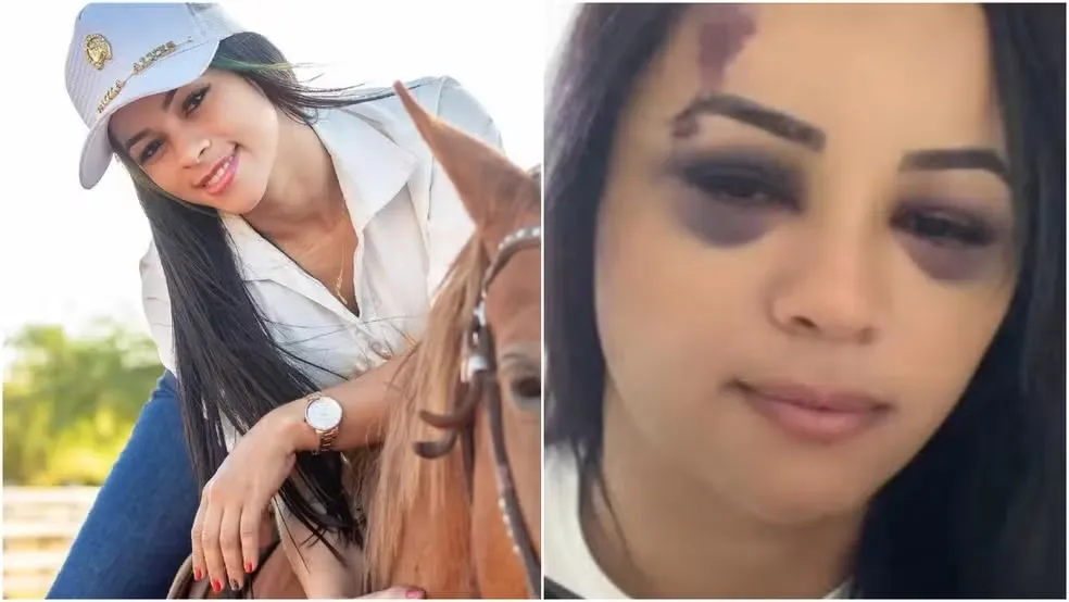 Suspeito de agredir influencer com taco de sinuca segue foragido