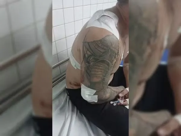 Policial é baleado por sargento do Exército durante discussão
