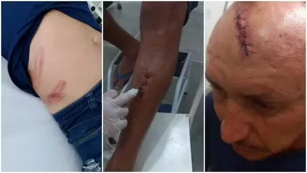 Reprodução