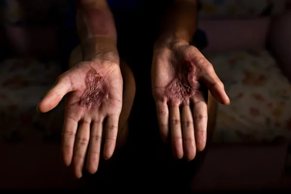 Breno Esaki/Metrópoles