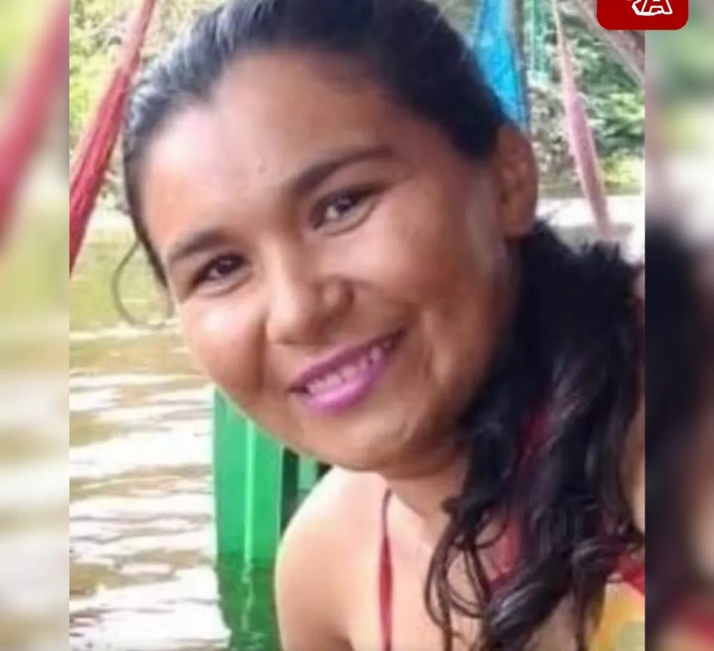 Mulher fica gravemente ferida após acidente de moto no bairro Pereiros