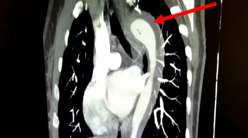 Foto: Divulgação / American Journal of Case Reports 