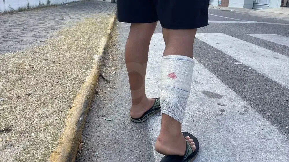 Foto: Mateus Ferreira/ SVM