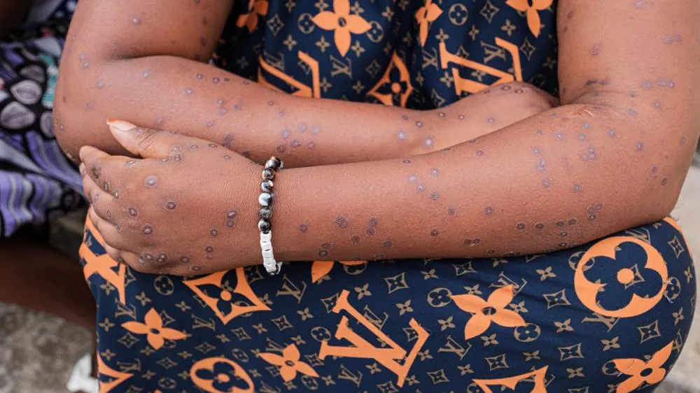 TCHANDROU NITANGA / AFP