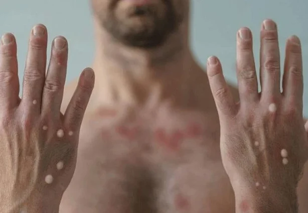 Foto: Reprodução/ SBT News