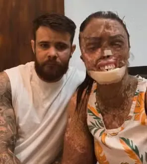Foto: Redes sociais/Reprodução